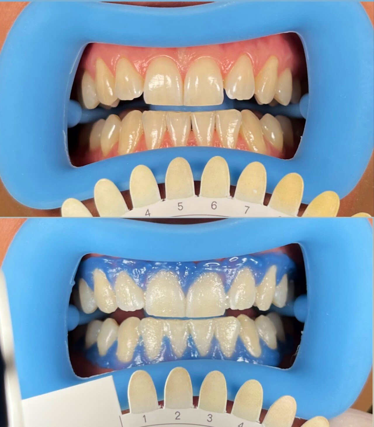 Dentist | Dokter Gigi | Giqu Dental Canggu