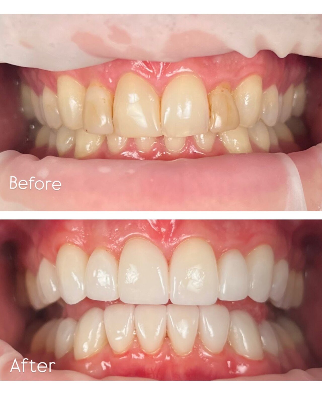 Dentist | Dokter Gigi | Giqu Dental Canggu