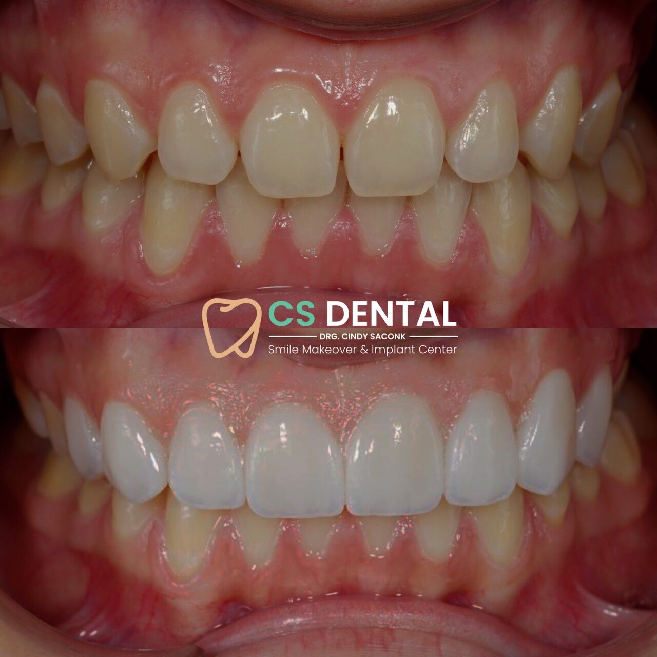 CS DENTAL BALI