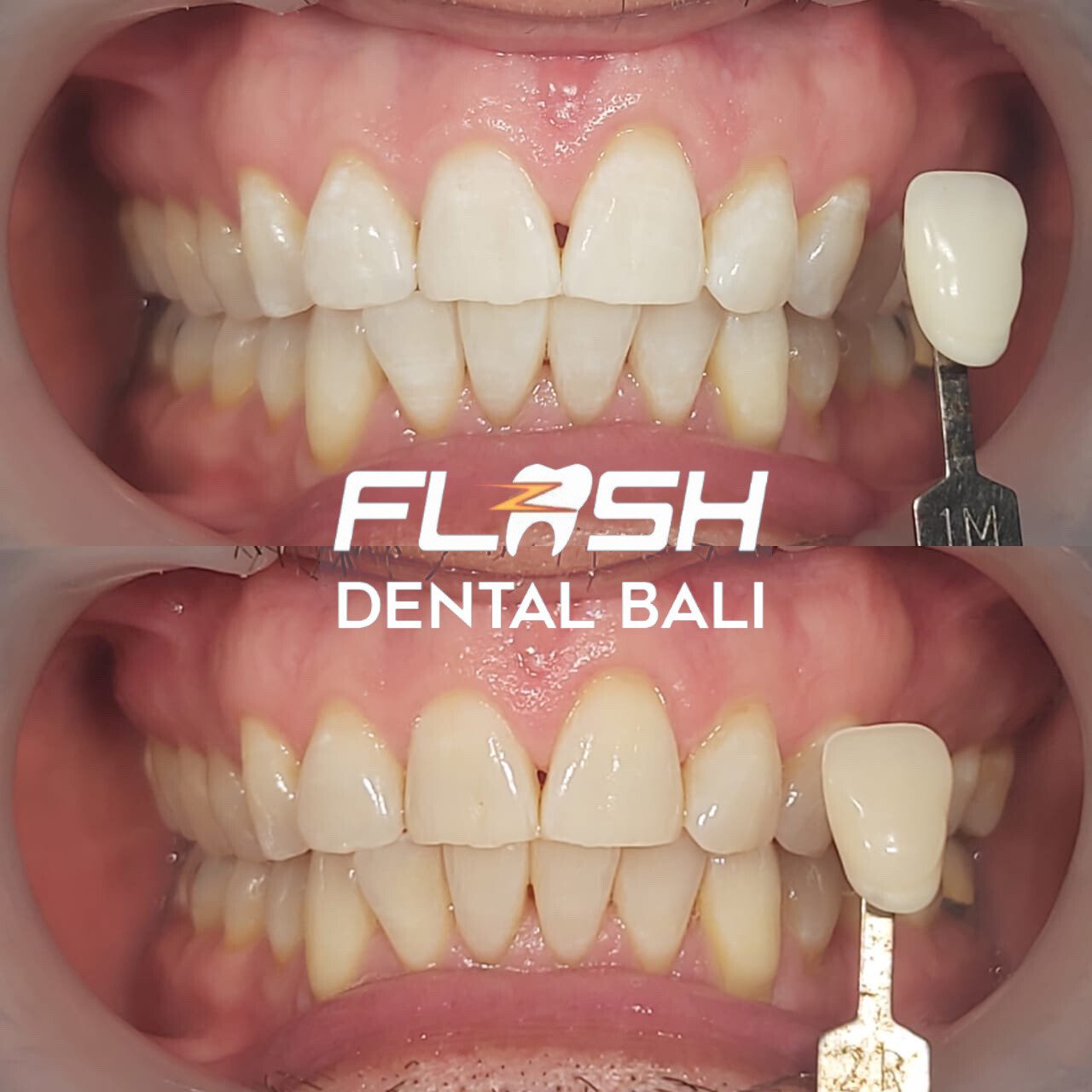 FLASH Dental Bali (seminyak)