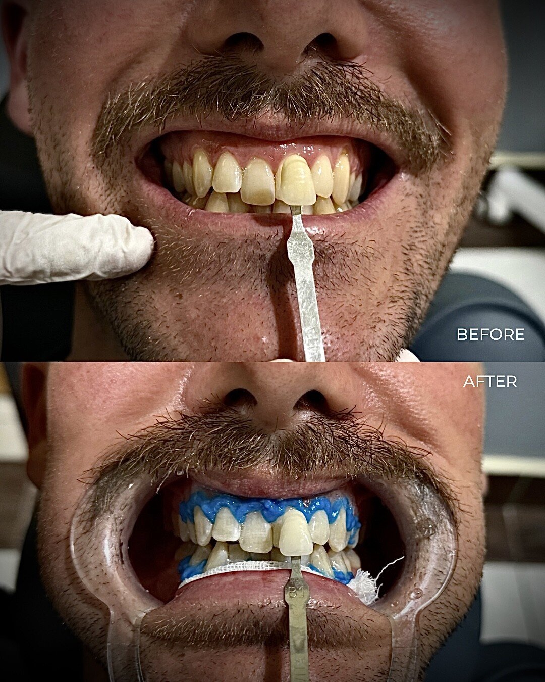 Bali Dental Assistance