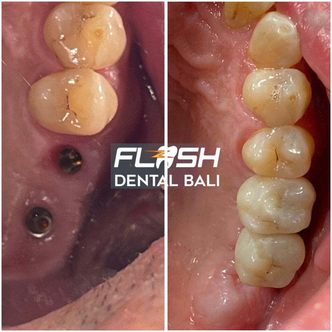 Flash Dental Bali Headoffice